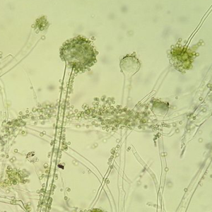 Aspergillus Oryzae